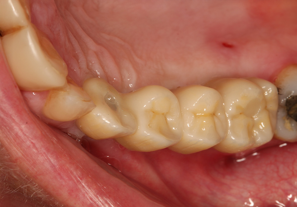 after image