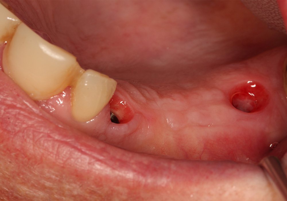 before image