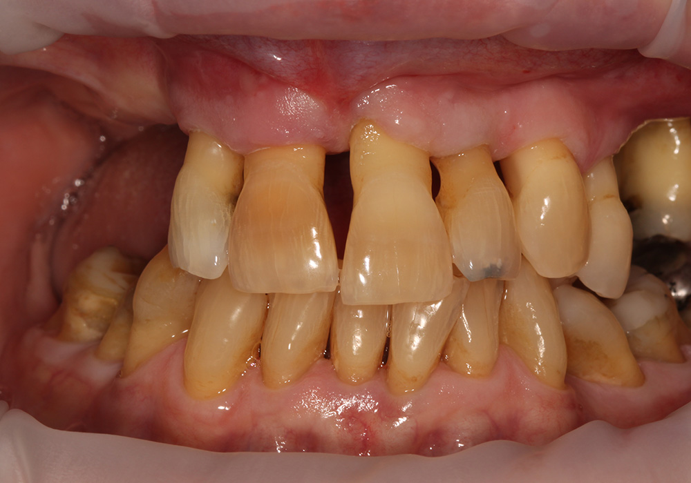 before image