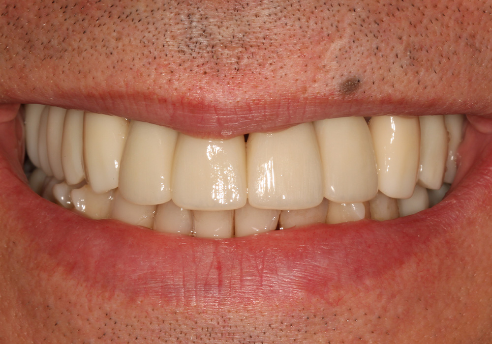 after image