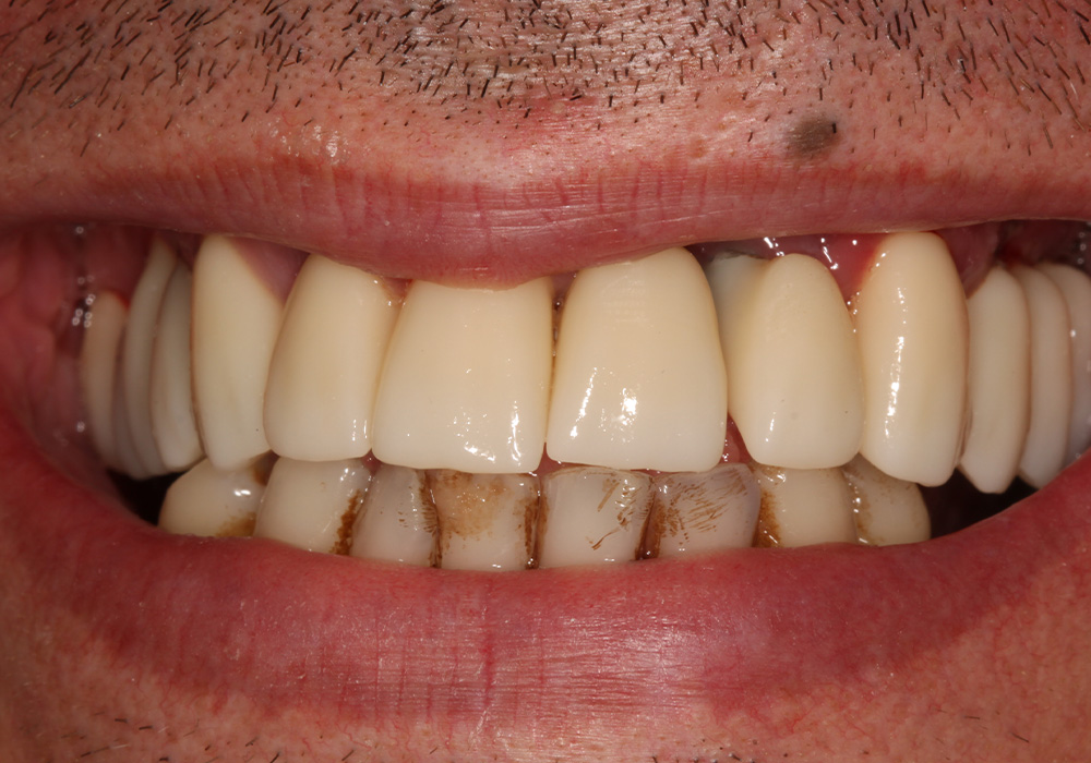 before image