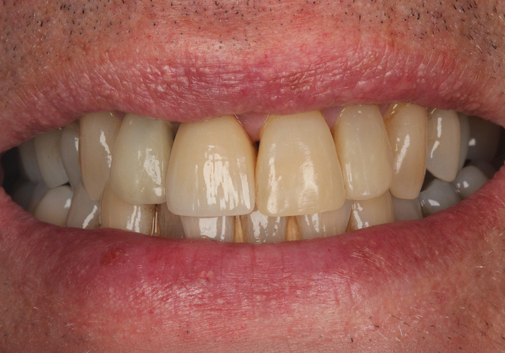 after image