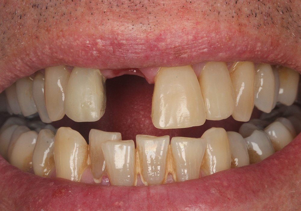 before image