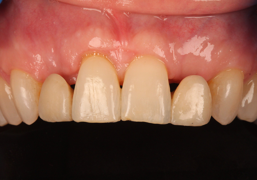 before image